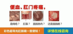 大便带血不疼是怎么回事？怎么办？