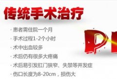传统痔疮手术有哪些?怎么治疗痔疮好?