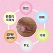 大便肛门疼痛类型是什么?该怎么办?